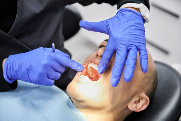 Best Emergency Wisdom Teeth Removal in Deenwood, GA
