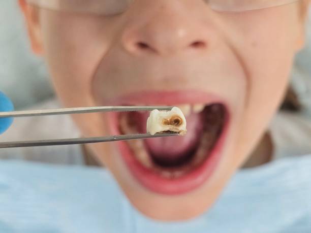 Best Emergency TMJ Treatment in Deenwood, GA